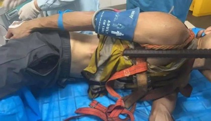 佛山一男子意外从高空坠落,1.5米长钢筋从肛门贯穿胸腔......