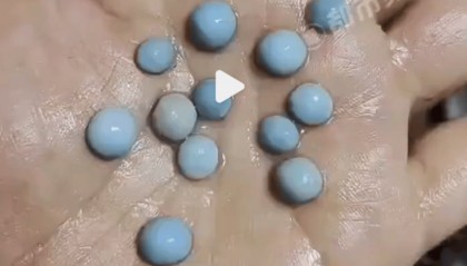 女子吃小龙虾竟剥出多颗珠子，网友：这是长结石了吧丨有话聊