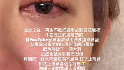 突然爆炸!知名女演员自曝:痛到大哭眩晕