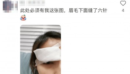 击穿眉骨、扎穿手指…这项人气运动暗藏风险!