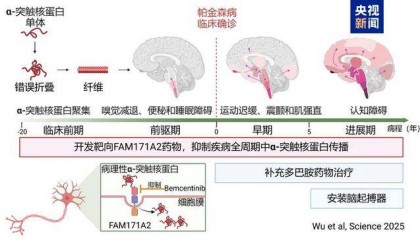 全球首次!复旦大学科研团队发现帕金森病全新治疗靶点